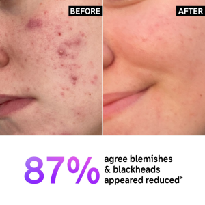 The Inkey List - Supersize Salicylic Acid Cleanser