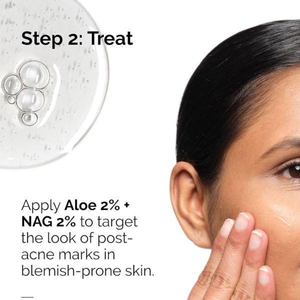 The Ordinary - Aloe 2% + NAG 2% Solution